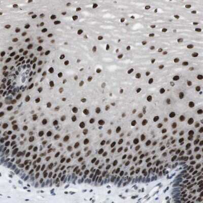 Immunohistochemistry-Paraffin: PA28 Activator gamma Subunit/PSME3 Antibody [NBP1-83063]