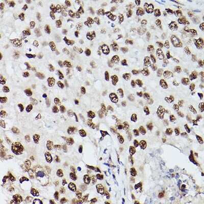 Immunohistochemistry-Paraffin: PA28 Activator gamma Subunit/PSME3 Antibody - Azide and BSA Free [NBP2-93183]