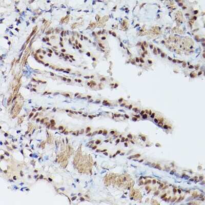 Immunohistochemistry-Paraffin: PA28 Activator gamma Subunit/PSME3 Antibody - Azide and BSA Free [NBP2-93183]