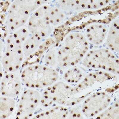 Immunohistochemistry-Paraffin: PA28 Activator gamma Subunit/PSME3 Antibody - Azide and BSA Free [NBP2-93183]