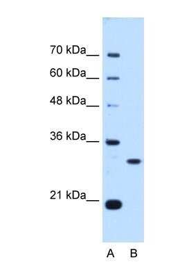 Western Blot: PA28 Activator gamma Subunit/PSME3 Antibody [NBP1-54587]