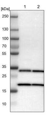 Western Blot: PA28 Activator gamma Subunit/PSME3 Antibody [NBP1-83063]