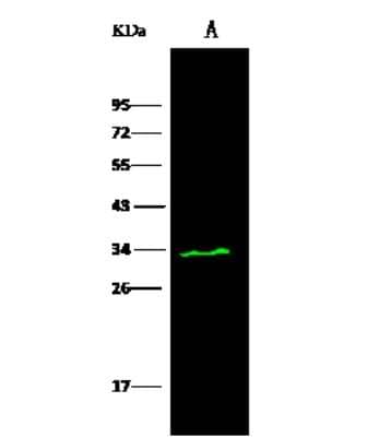 Western Blot: PA28 Activator gamma Subunit/PSME3 Antibody [NBP3-00356]