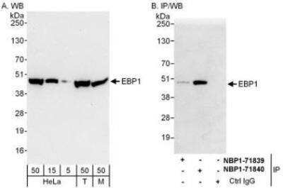 Western Blot: PA2G4/EBP1 Antibody [NBP1-71840]