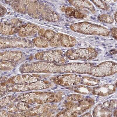 Immunohistochemistry-Paraffin: PAAF1 Antibody [NBP1-82310]