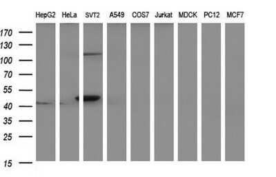 Western Blot: PAAF1 Antibody (OTI1F11) [NBP2-46309]