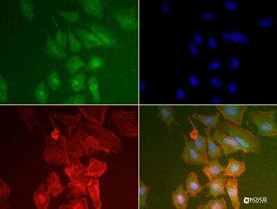 Immunocytochemistry/ Immunofluorescence: PABP Antibody (10E10) - BSA Free [NB120-6125]