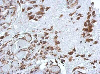 Immunohistochemistry-Paraffin: PABP Antibody [NBP2-19670]