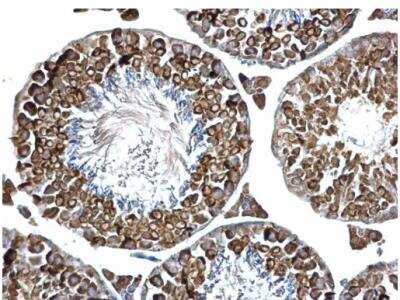 Immunohistochemistry-Paraffin: PABP Antibody [NBP2-19670]