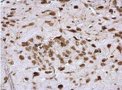 Immunohistochemistry-Paraffin: PABP Antibody [NBP2-19670]