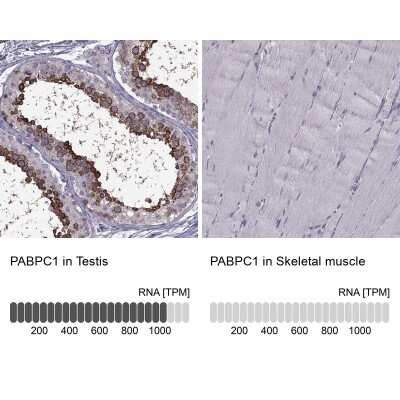 Immunohistochemistry-Paraffin: PABP Antibody [NBP2-54722]