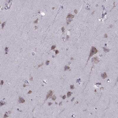 Immunohistochemistry-Paraffin: PABP Antibody [NBP2-54722]