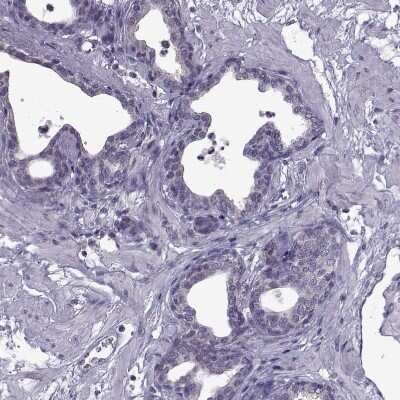 Immunohistochemistry-Paraffin: PABP Antibody [NBP2-54722]