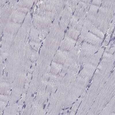 Immunohistochemistry-Paraffin: PABP Antibody [NBP2-54722]
