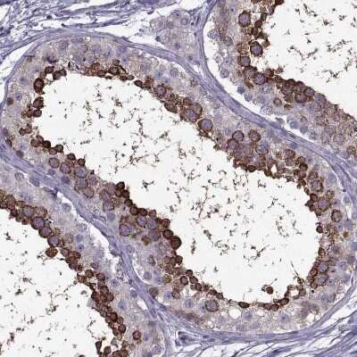 Immunohistochemistry-Paraffin: PABP Antibody [NBP2-54722]