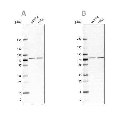 Western Blot: PABP Antibody [NBP2-57869]