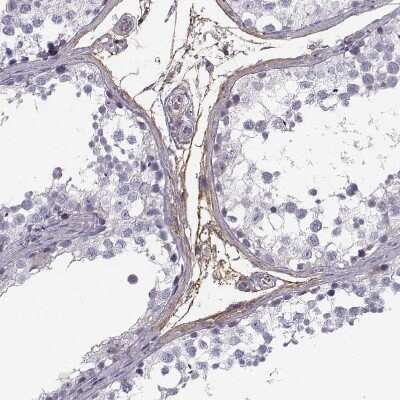 Immunohistochemistry-Paraffin: PABPC1L2A Antibody [NBP2-54693]