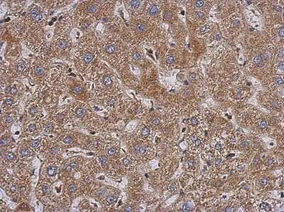 Immunohistochemistry-Paraffin: PABPC3 Antibody [NBP2-15061]