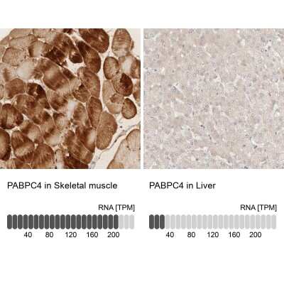 Immunohistochemistry-Paraffin: PABPC4 Antibody [NBP2-13722]