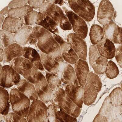 Immunohistochemistry-Paraffin: PABPC4 Antibody [NBP2-13722]
