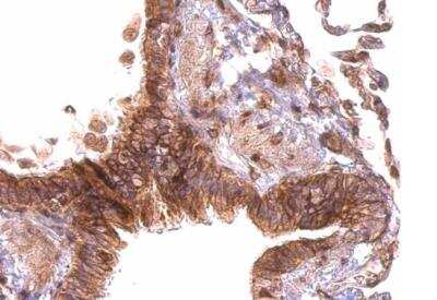 Immunohistochemistry-Paraffin: PABPC4 Antibody [NBP2-19671]