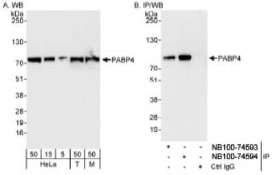 Western Blot: PABPC4 Antibody [NB100-74593]