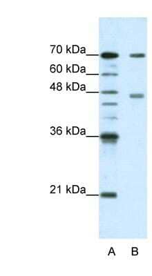 Western Blot: PABPC4 Antibody [NBP1-57448]