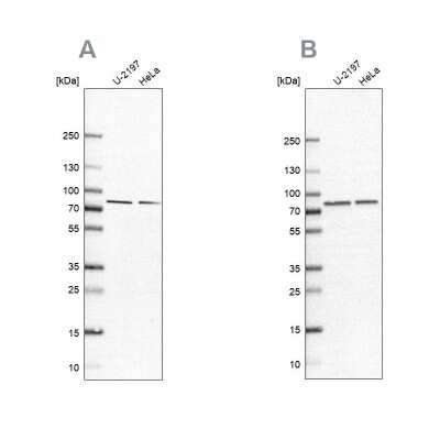 Western Blot: PABPC4 Antibody [NBP2-13722]