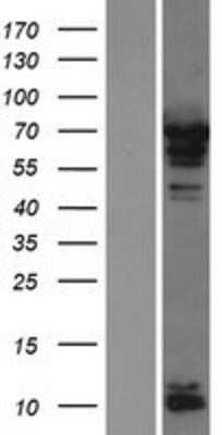 Western Blot: PABPC4 Overexpression Lysate [NBP2-07951]