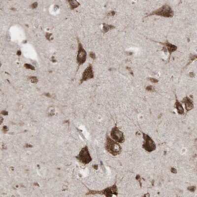 Immunohistochemistry-Paraffin: PABPC5 Antibody [NBP1-87355]