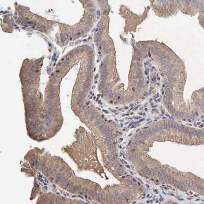 Immunohistochemistry-Paraffin: PABPC5 Antibody [NBP1-87356]