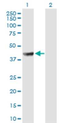 Western Blot: PABPC5 Antibody [H00140886-B01P]