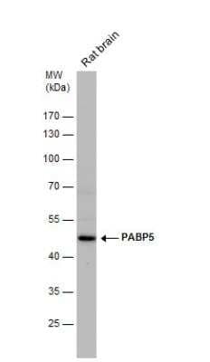 Western Blot: PABPC5 Antibody [NBP2-19672]