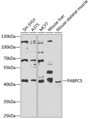 Western Blot: PABPC5 AntibodyBSA Free [NBP2-94352]