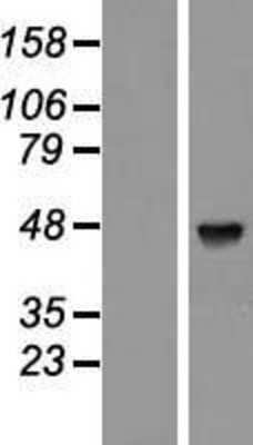 Western Blot: PABPC5 Overexpression Lysate [NBL1-14057]