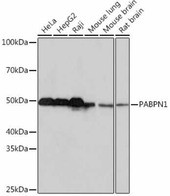 Western Blot: PABPN1 Antibody (7V4X8) [NBP3-15539]