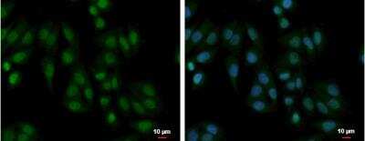 Immunocytochemistry/ Immunofluorescence: PABPN1 Antibody [NBP1-31805]