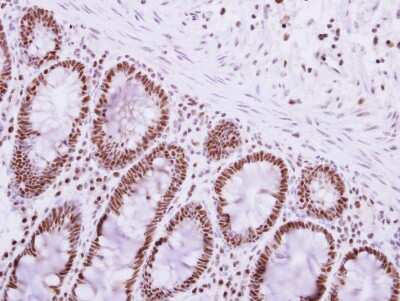 Immunohistochemistry-Paraffin: PABPN1 Antibody [NBP1-31805]