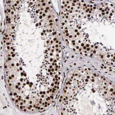Immunohistochemistry-Paraffin: PABPN1 Antibody [NBP1-82481]