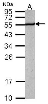 Western Blot: PABPN1 Antibody [NBP1-31805]