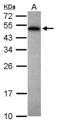 Western Blot: PABPN1 Antibody [NBP1-31805]