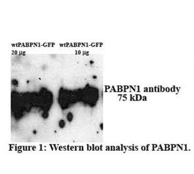 Western Blot: PABPN1 Antibody [NBP1-57216]