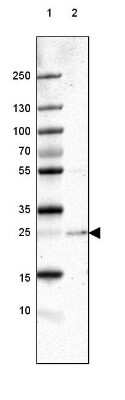 Western Blot: PABPN1 Antibody [NBP1-82481]