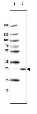 Western Blot: PABPN1 Antibody [NBP1-82481]