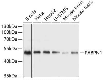 Western Blot: PABPN1 AntibodyBSA Free [NBP2-93664]