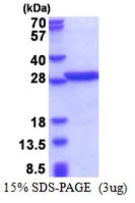 SDS-PAGE: Recombinant Human PABPN1 His Protein [NBP2-51516]