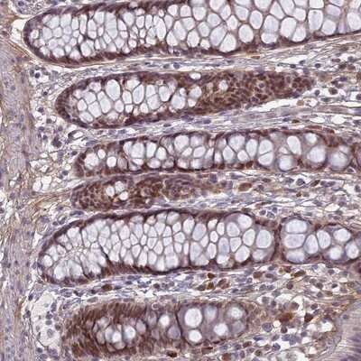 Immunohistochemistry-Paraffin: PABPN1L Antibody [NBP1-94055]