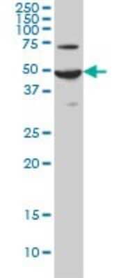 Western Blot: PAC1R Antibody (2B12) [H00000117-M01]