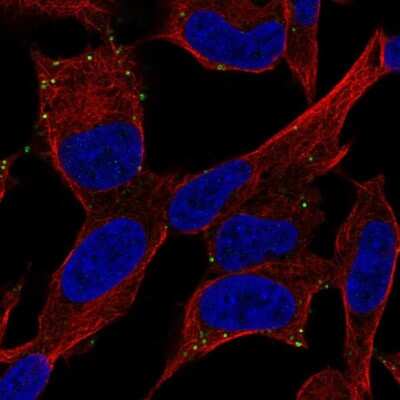 Immunocytochemistry/ Immunofluorescence: PAC1R Antibody [NBP2-68620]