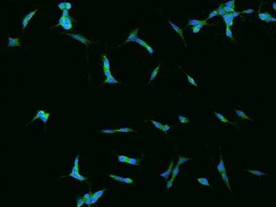 Immunocytochemistry/ Immunofluorescence: PAC1R Antibody [NBP2-97421]